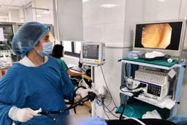 Không có triệu chứng, người phụ nữ bất ngờ phát hiện sán dây bò 70 cm