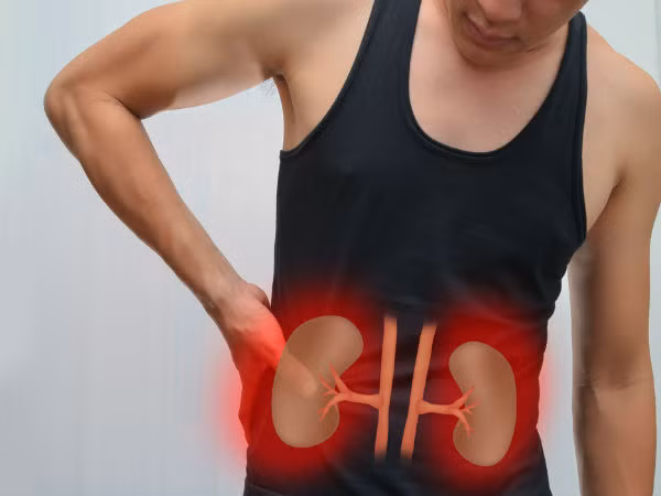 Giật mình 9 nhóm người dễ suy thận, số 5 bất ngờ nhất - Hình 4