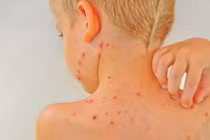 Vì sao nhiễm khuẩn đường huyết có thể gây tử vong