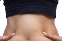 Béo phì nội tạng - những hệ lụy ít ai ngờ ở người trẻ