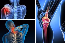 Thói quen xấu khiến bệnh xương khớp ngày càng trẻ hóa