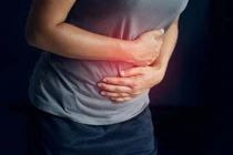 Xu hướng gia tăng bệnh dạ dày ở người trẻ 