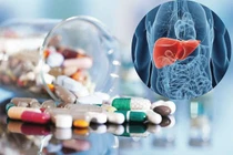 Rủi ro tiềm ẩn khi sử dụng thuốc xách tay