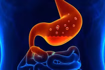 Thay đổi thói quen hàng ngày giúp kiểm soát axit dạ dày hiệu quả