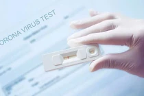 Khi nào nên tự test nhanh tại nhà?