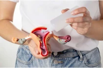 Các bệnh phụ khoa thường gặp ở phụ nữ trẻ