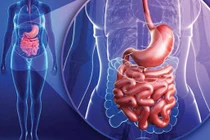 Dấu hiệu hội chứng ruột rò rỉ, cách phòng ngừa