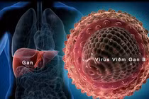 Những hiểu lầm phổ biến về viêm gan B và C bạn cần biết