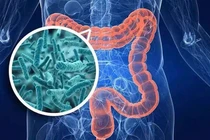 Sử dụng lợi khuẩn đúng cách, cải thiện hệ tiêu hóa và miễn dịch