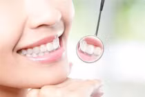 Răng trắng với những mẹo đơn giản tại nhà