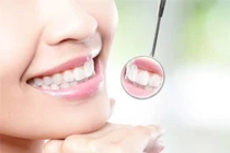 Răng trắng với những mẹo đơn giản tại nhà