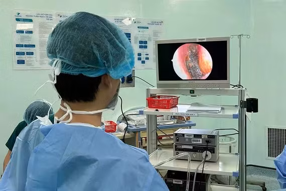 Gắp thành công pin cúc áo nằm sâu trong mũi bé trai 4 tuổi