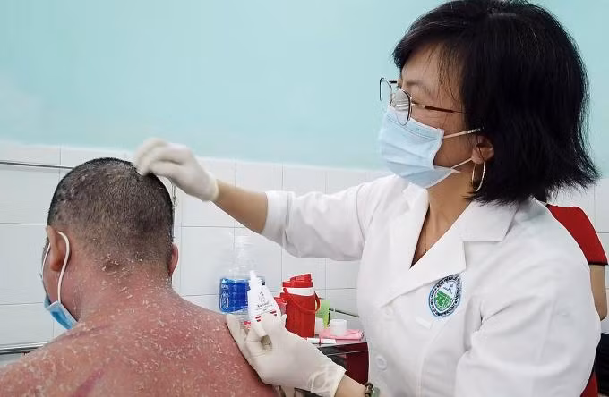 Bệnh nhân bị vảy nến biến chứng nặng