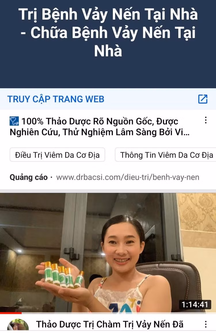 Quảng cáo thảo dược trị vảy nến trên Youtube