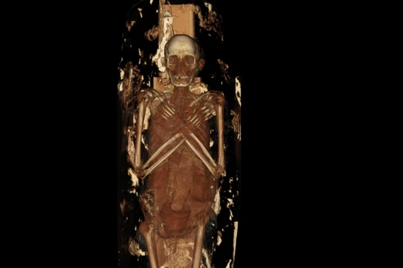 Chụp CT khám phá diện mạo, bệnh lý của xác ướp Ai Cập cổ đại