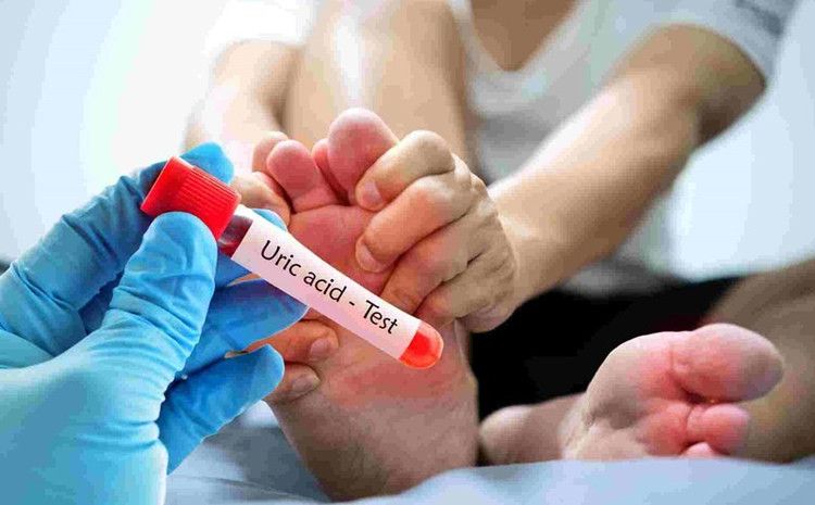 nguoi-co-axit-uric-tang-cao.jpg