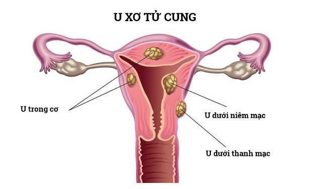 u-tu-cung-1.jpg