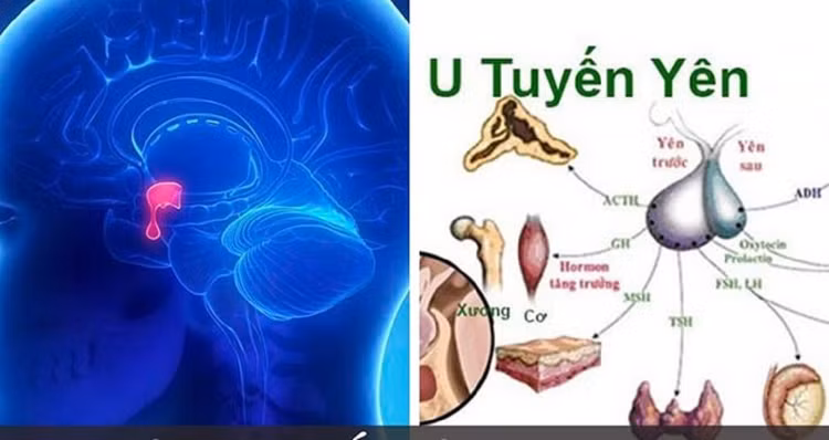 tuyen-yen-326.jpg
