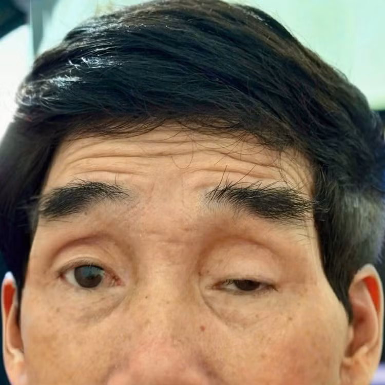 sup-mi.jpg
