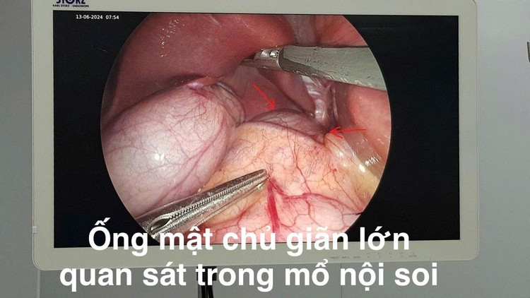 nang-ong-mat-chu.jpg