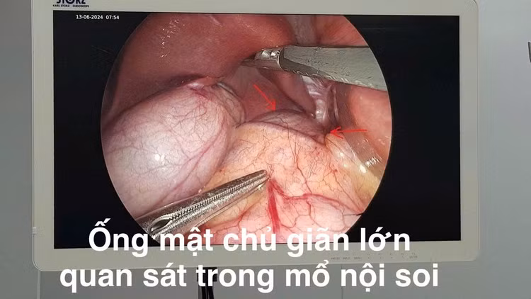 nang-ong-mat-chu.jpg
