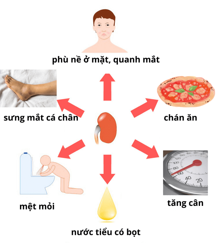 trieu-chung-hoi-chung-than-hu.png