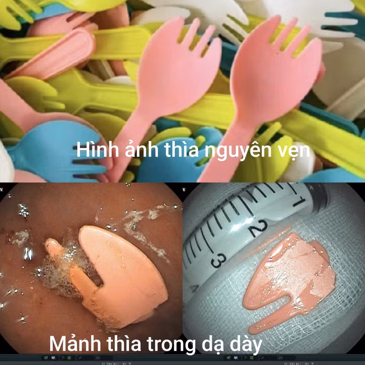 thia-nhua-2.jpg
