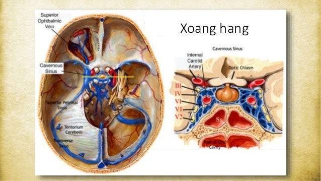 xoang-hang-1.jpg