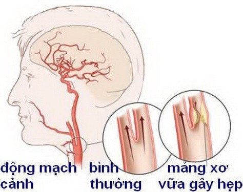 dong-mach-canh-1.jpg
