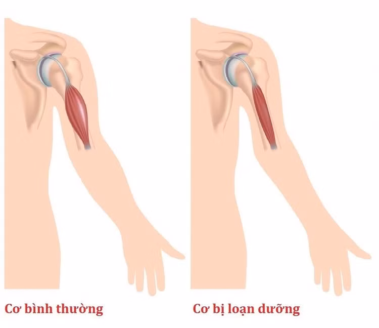 loan-duong-co.jpg