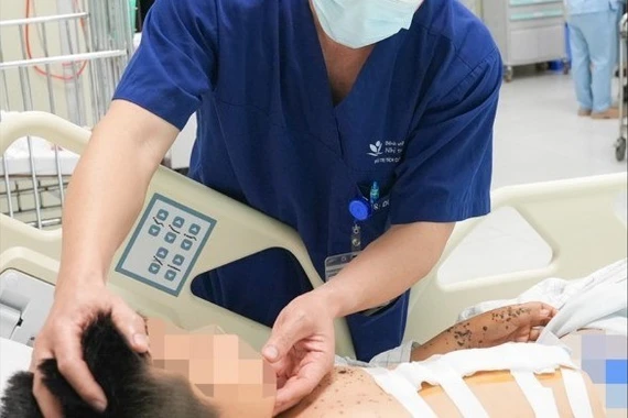 Nhặt được vật lạ để nghịch trẻ 9 tuổi nguy kịch từ kíp nổ tự chế