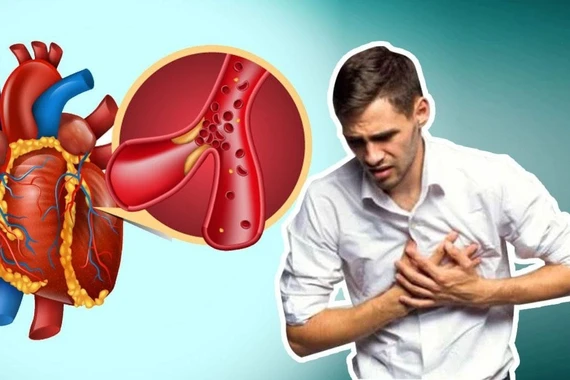 Bệnh 'sát thủ thầm lặng' ít dấu hiệu cảnh báo, hậu quả rất nặng