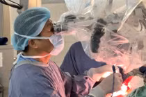 Đặt điện cực định vị cắt khối u thần kinh đệm kích thước 8cm trong não