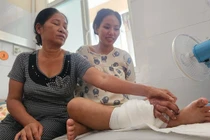 Ghép tạm tay đứt lìa vào chân bảo tồn tay cho thai phụ mang song thai 