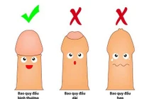 Tự lộn bao quy đầu, thanh niên 16 tuổi phải cấp cứu