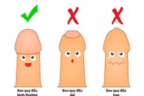 Tự lộn bao quy đầu, thanh niên 16 tuổi phải cấp cứu