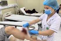 Nhiều người gãy xương, chấn thương vì mưa đường trơn trượt