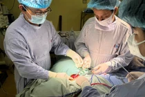 Chủ quan không đi khám u thành bụng tái phát đường kính 20cm