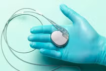 Máy tạo nhịp tim khắc phục nhịp chậm thế nào?