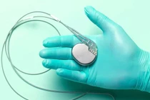 Máy tạo nhịp tim khắc phục nhịp chậm thế nào?