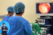 Mờ mắt do u tuyến yên