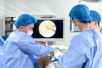 Tái tạo dây chằng, khâu sụn chêm phục hồi gối tổn thương