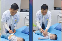 30 phút nghẹt thở giành lại sự sống cho bệnh nhi 7 tháng tuổi bị lồng ruột