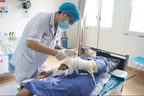 Người đàn ông bị bỏng nặng do đốt rác bằng xăng