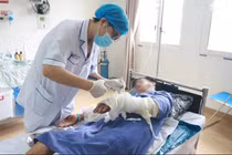 Người đàn ông bị bỏng nặng do đốt rác bằng xăng