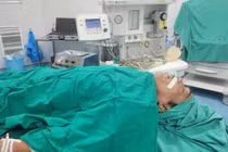 Người đàn ông uống nhầm vỏ thuốc gây tổn thương thực quản