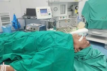 Người đàn ông uống nhầm vỏ thuốc gây tổn thương thực quản