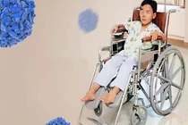 Phát hiện ổ dịch bại liệt tại Lào, Bộ Y tế họp toàn quốc chỉ đạo phòng chống