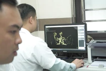 Chậm trễ trong điều trị đột quỵ, nguy cơ tử vong, di chứng nặng