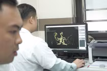 Chậm trễ trong điều trị đột quỵ, nguy cơ tử vong, di chứng nặng